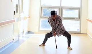 Viêm cột sống dính khớp, hai chân của nam thanh niên khuỳnh như càng cua