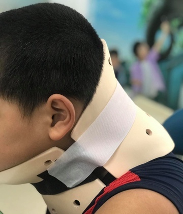 Bé trai 10 tuổi bị chấn thương cột sống cổ do bắt chước trò nhào lộn trên TikTok