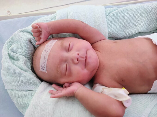 Hành trình hồi sinh kỳ diệu của bé gái sinh non chỉ nặng 0,6 kg