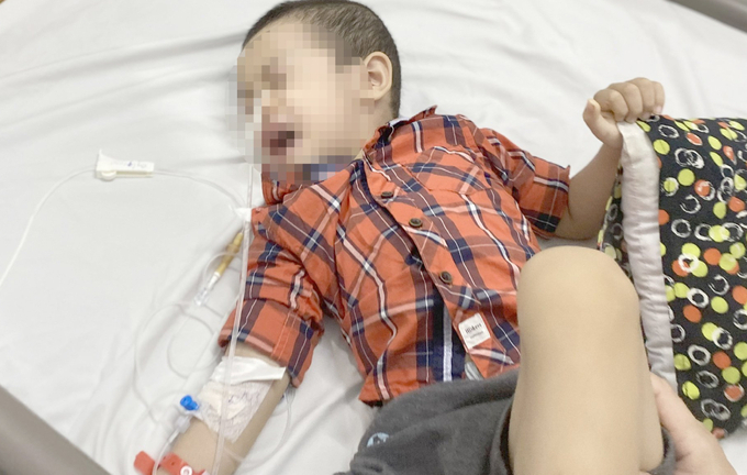 Nuốt pin đồng xu, bé trai 4 tuổi bị bỏng thực quản