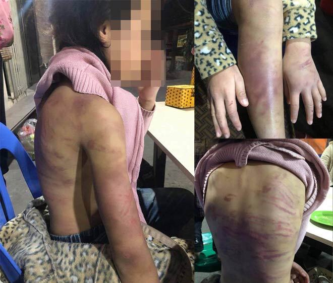 Trần tình của người mẹ bạo hành con gái 12 tuổi ở Hà Nội