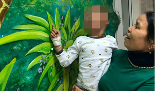 Cứu sống bé hơn 4 tuổi ở Thanh Hóa bị chó cắn vào đầu