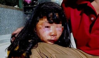 Nữ sinh lớp 6 bị kẻ lạ mặt tấn công dã man trên đường đi học về