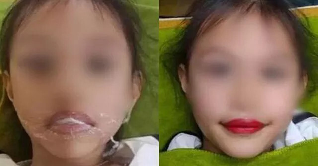 Từ vụ bé 5 tuổi xăm môi, chuyên gia cảnh báo những hệ lụy khó lường tuyệt đối không nên chủ quan