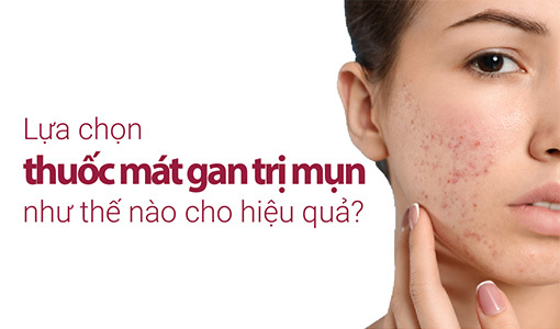 thuốc mát gan trị mụn