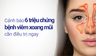 Cảnh báo 6 triệu chứng bệnh viêm xoang mũi cần điều trị ngay