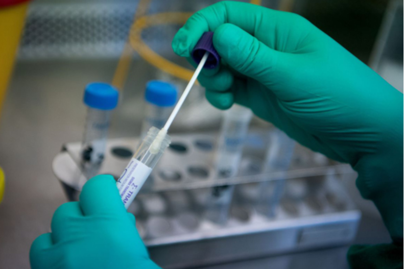 Yêu cầu Bộ Y tế làm rõ thông tin kit test phát hiện biến thể Omicron