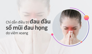 Chỉ dẫn điều trị đau đầu sổ mũi đau họng do viêm xoang
