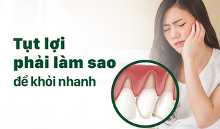 Làm gì để khỏi nhanh tụt lợi, bảo vệ răng miệng toàn diện?