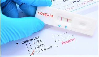 Bộ Y tế yêu cầu kiểm tra, xử phạt việc găm hàng và 'thổi giá' kit test Covid-19