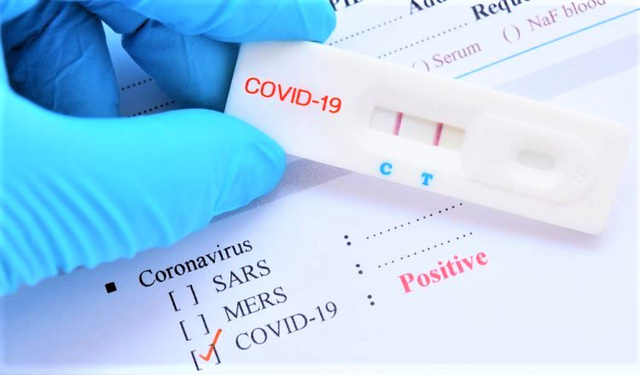 Bộ Y tế yêu cầu kiểm tra, xử phạt việc găm hàng và thổi giá kit test Covid-19