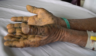 Tự dùng thuốc để tăng cường 'bản lĩnh', người đàn ông nhận cái kết đáng sợ