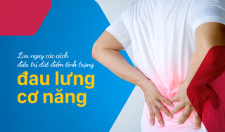 Lưu ngay các cách điều trị dứt điểm tình trạng đau lưng cơ năng