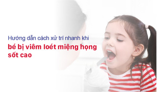Hướng dẫn cách xử trí nhanh khi bé bị viêm loét miệng họng sốt cao