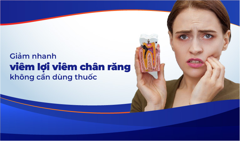 Viêm lợi viêm chân răng q