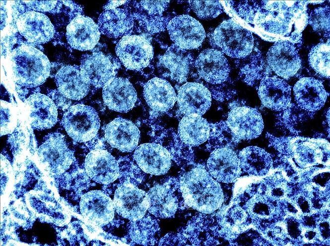 Tìm thấy 47 đột biến mới của chủng virus đậu mùa khỉ đang lây lan toàn cầu