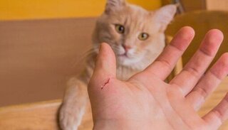 Bị mèo cắn nhưng không tiêm phòng dại, thiếu nữ 16 tuổi tử vong