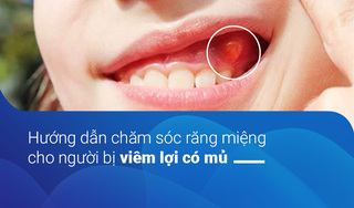 Hướng dẫn chăm sóc răng miệng cho người bị viêm lợi có mủ