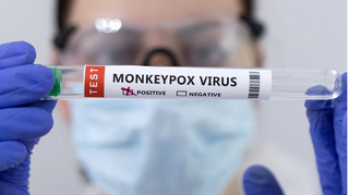 Mỹ tuyên bố tình trạng khẩn cấp về bệnh đậu mùa khỉ