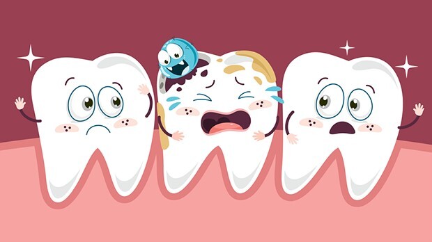 sâu răng hàm có lỗ