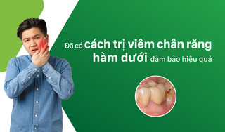 Đã có cách trị viêm chân răng hàm dưới đảm bảo hiệu quả