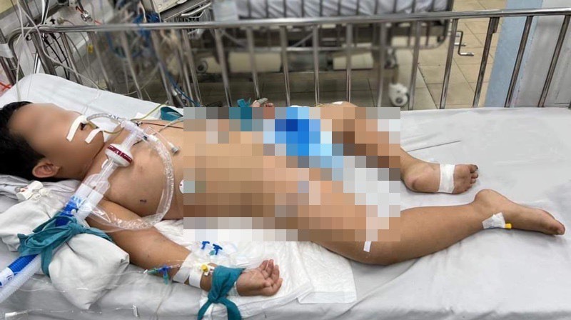 Bé trai 7 tuổi ở TP HCM bị viêm não hoại tử hiếm gặp
