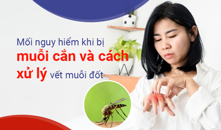 Mối nguy hiểm khi bị muỗi cắn và cách xử lý vết muỗi đốt
