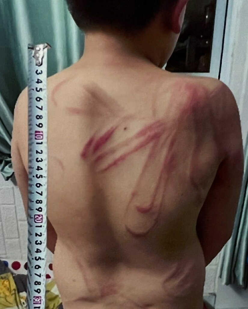 Bắt người bố bạo hành con ruột dã man ở Lâm Đồng