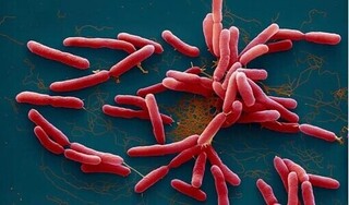 Những biểu hiện thường gặp khi mắc 'vi khuẩn ăn thịt người'