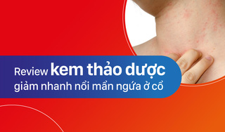 Review kem thảo dược giảm nhanh nổi mẩn ngứa ở cổ