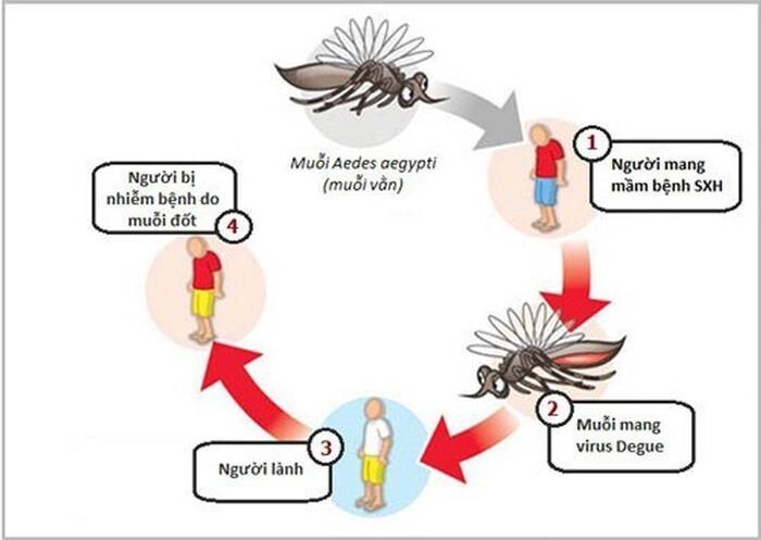 sốt xuất huyết Dengue