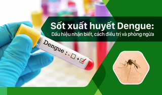 Sốt xuất huyết Dengue: Dấu hiệu nhận biết, điều trị và phòng ngừa