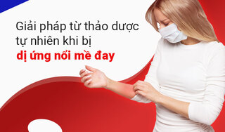 Giải pháp từ thảo dược tự nhiên khi bị dị ứng nổi mề đay