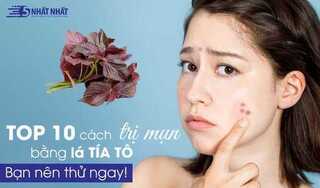 TOP 10 cách dùng lá tía tô trị mụn nhanh hiệu quả bạn nên thử ngay