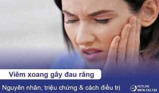 Nguyên nhân và cách điều trị viêm xoang gây đau răng