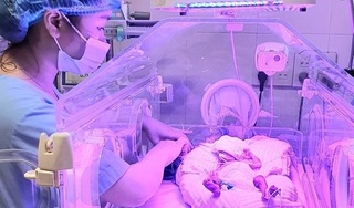 Bé sinh non hơn 24 tuần, chỉ nặng 700g đã xuất viện khỏe mạnh