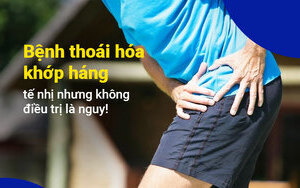 Bệnh thoái hóa khớp háng: tế nhị nhưng không điều trị là nguy!