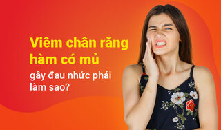 Viêm chân răng hàm có mủ gây đau nhức phải làm sao?