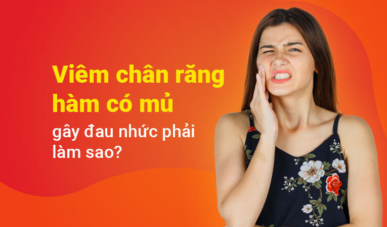 Viêm chân răng hàm có mủ 