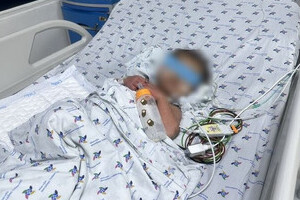 Bé trai 27 tháng tuổi nguy kịch do sốc sốt xuất huyết trên nền bệnh tim bẩm sinh