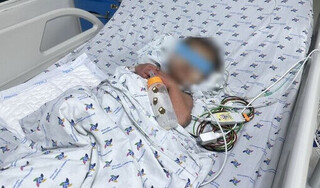 Bé trai 27 tháng tuổi nguy kịch do sốc sốt xuất huyết trên nền bệnh tim bẩm sinh