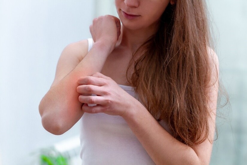 Khám phá 5 nguyên nhân dẫn đến mẩn ngứa trên da
