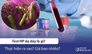 Test HP dạ dày là gì? Thực hiện ra sao? Giá bao nhiêu?