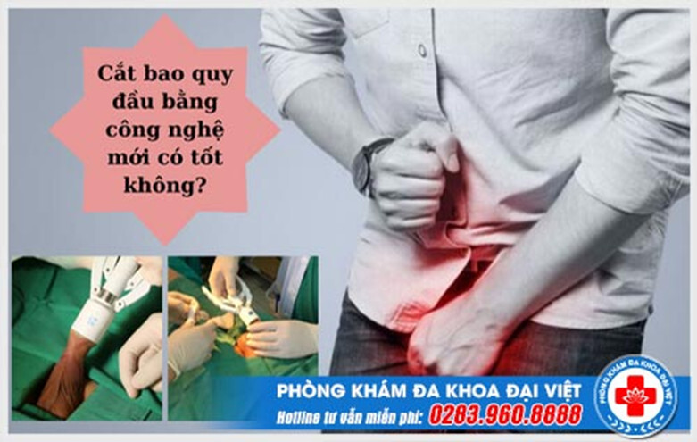 Cắt bao quy đầu và những điều cần biết