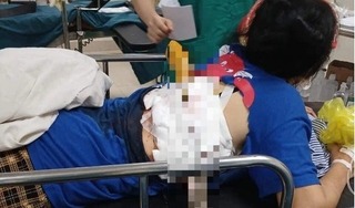 Một phụ nữ ở Hà Tĩnh bị chồng dùng dao nhọn phóng xuyên lưng