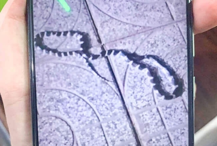 Ngủ dưới nền nhà, bé trai hơn 2 tuổi bị rắn độc cắn nguy kịch
