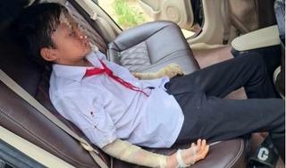 Lộ nguyên nhân vụ nổ bóng bay khiến 6 học sinh dự lễ khai giảng phải nhập viện ở Thanh Hóa