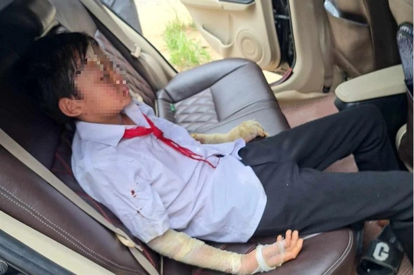 Thanh Hóa: Nổ bóng bay trong lễ khai giảng, 6 học sinh bị thương phải nhập viện