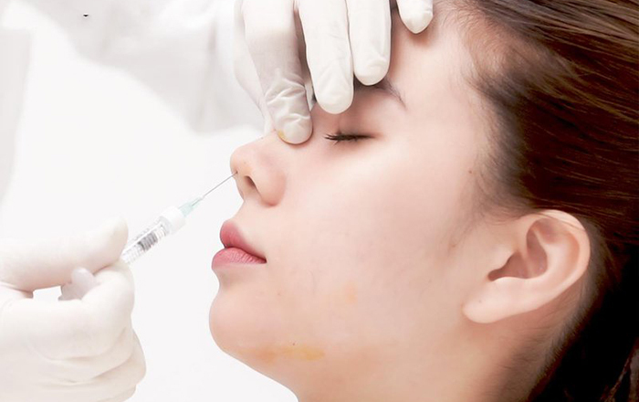 Tiêm filler ở nhà nghỉ gặp biến chứng và mất hết tài sản