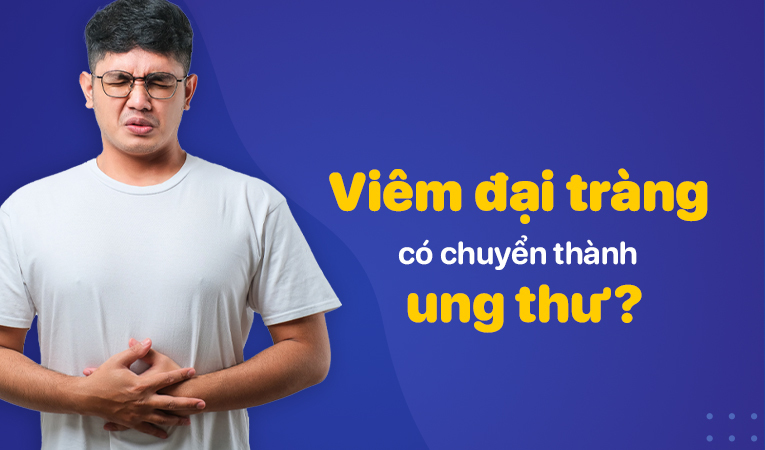 Viêm đại tràng có chuyển thành ung thư không?